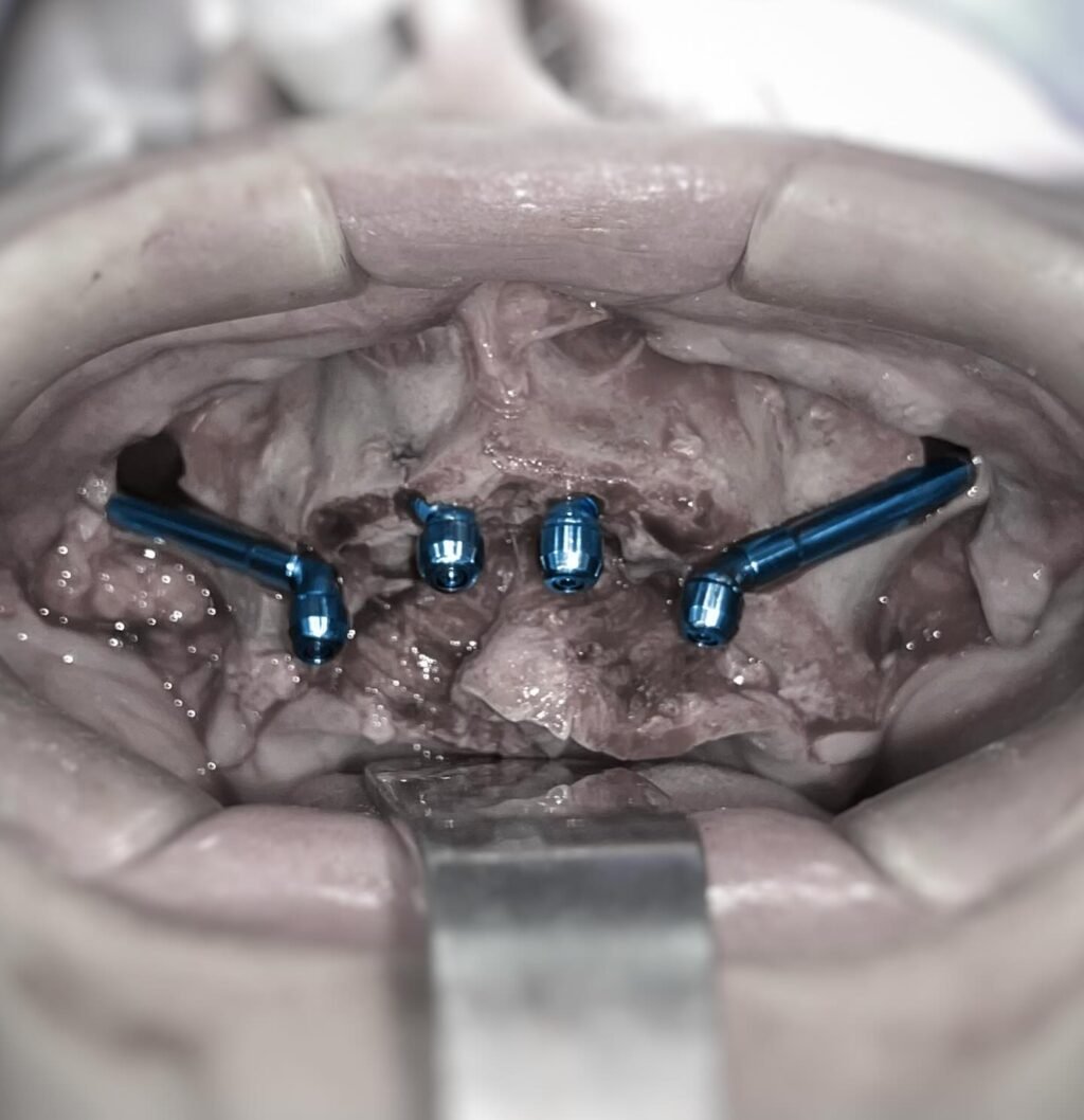 Instagram post from dr.rafaelmaia.bucomaxilo. This post is in position 3.